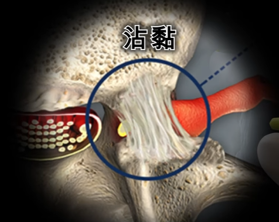 椎小關節結構示意